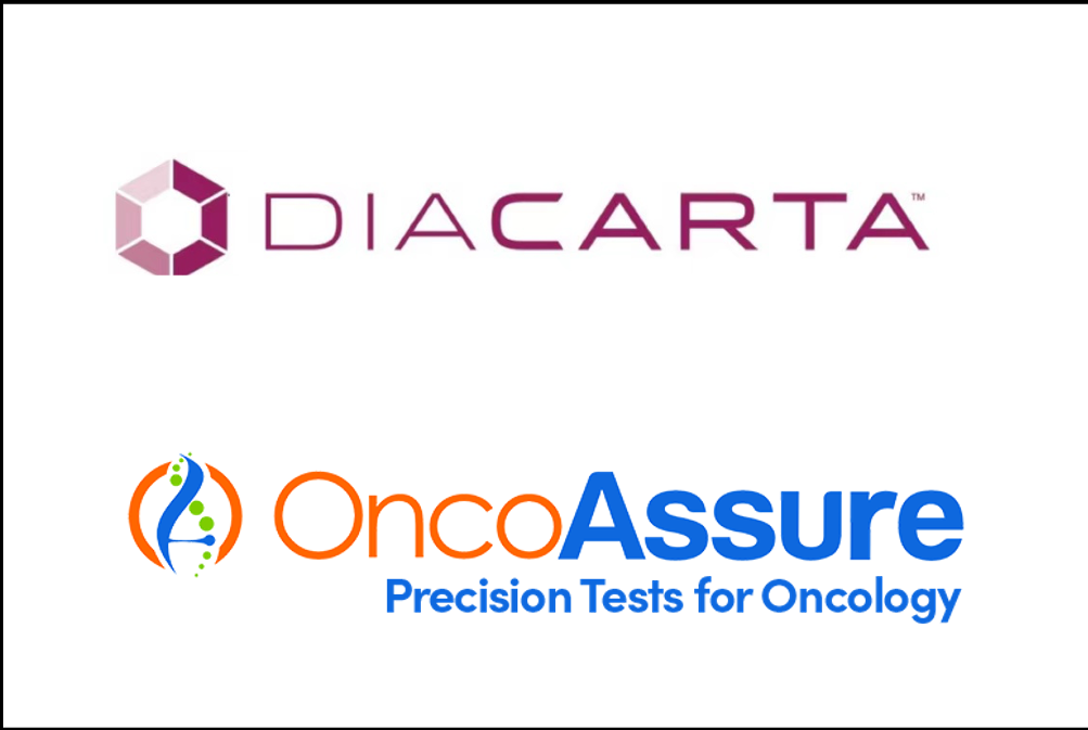 DiaCarta, Inc. and OncoAssure Ltd. Collaborate to Launch Prostate Cancer Lab Developed Test