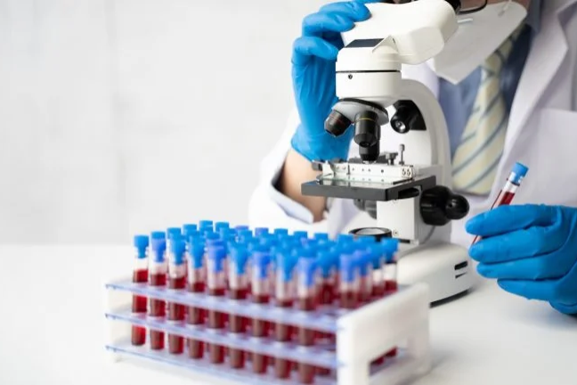 Labcorp launches blood test for neurodegenerative diseases detection