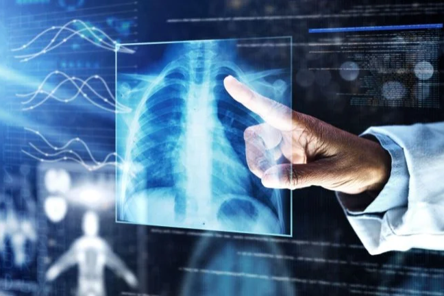 ARC and Roche collaborate to enhance NSCLC diagnostics using AI