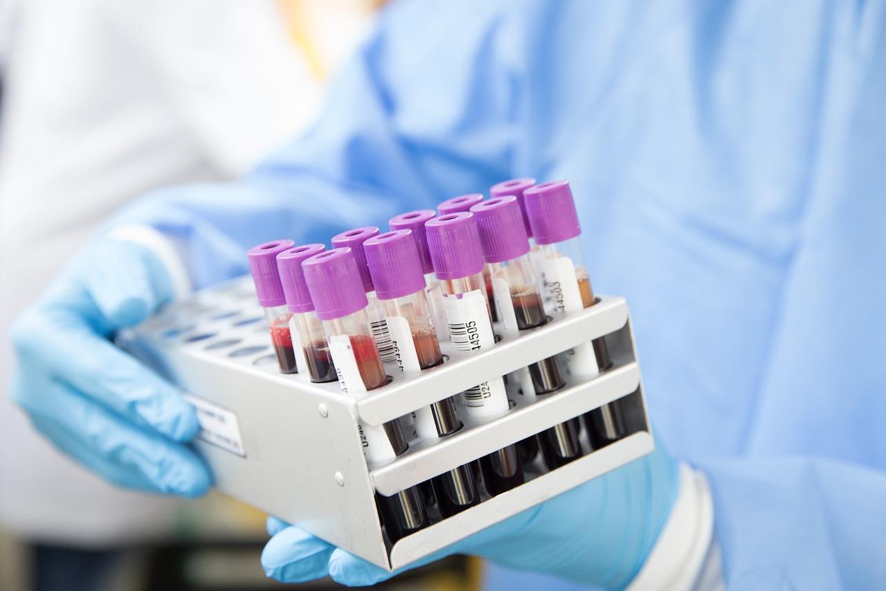 In Vitro Diagnostic Industry in China - Urine VI